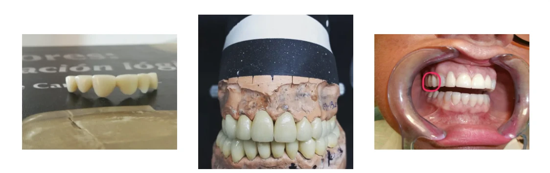 Customer feedback on 98×14 HT white zirconia disc Customer feedback on 98×14 HT white zirconia disc